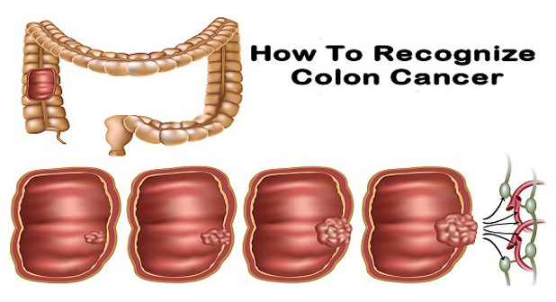 1513823602869055.png 1513823602869055.png