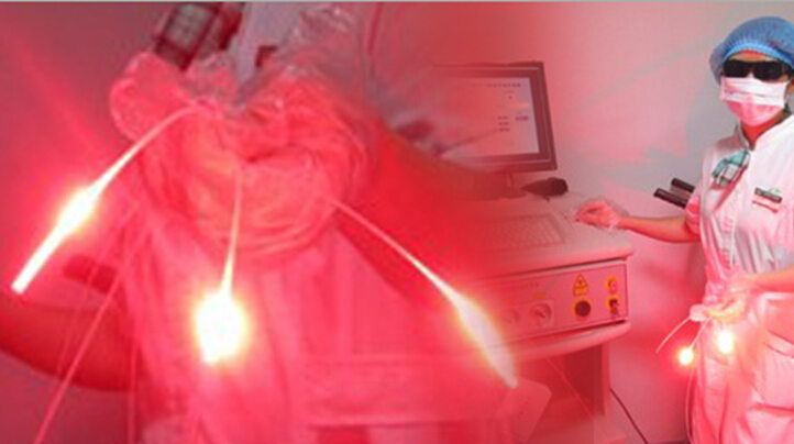 光動力療法 第五種國際公認(rèn)的癌癥治療方法